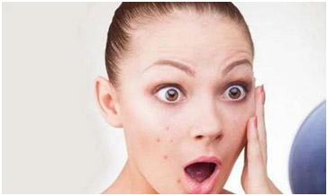 有“痘”不留“痕”，爱美的你看过来…(图1)